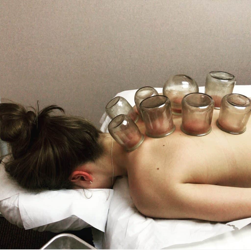 Photos and Video of Cupping